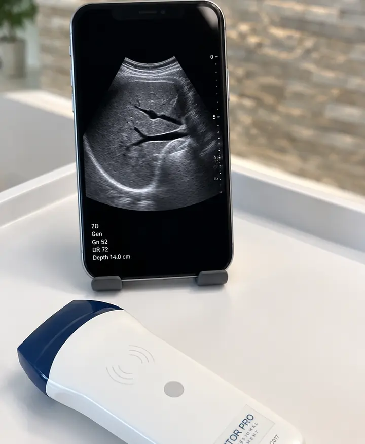 Sonda ecográfica inalámbrica Doctor Pro junto a un celular con la imagen